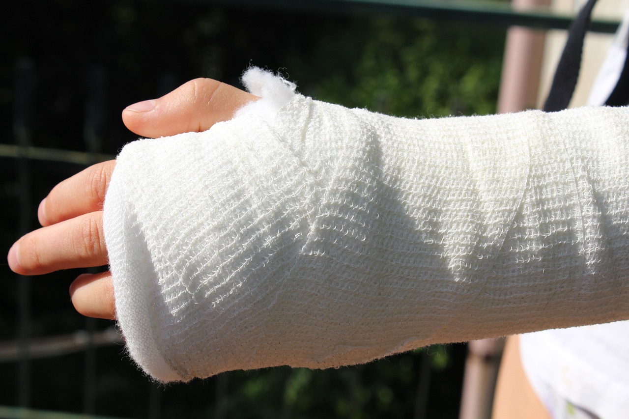 sprain